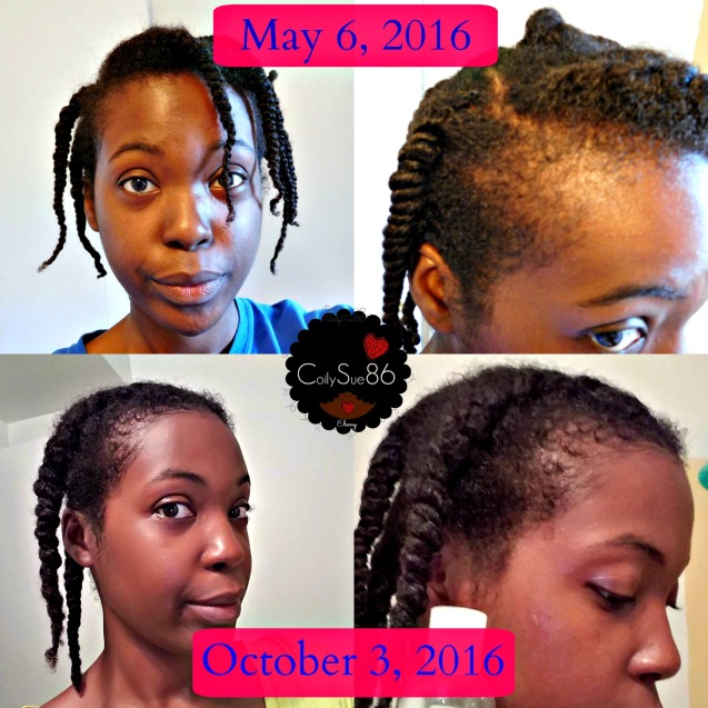 hair-growth-progress-project-pic-1-w-logo